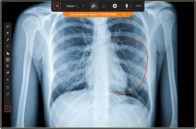 Обсуждение рентгеновского снимка с помощью инструментов для совместной работы Труконф
